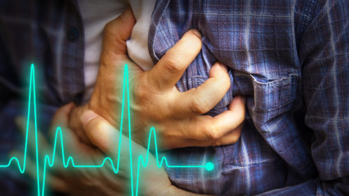 Cardiac Arrest vs Heart Attack: A Doctor Explains the Difference